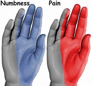 carpal-tunnel2
